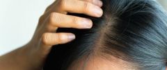 باحث يوضح أسباب تساقط الشعر.. ومتى يكون تساقطه طبيعياً؟
