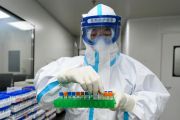 بعد “إيبولا” و”سارس” و”ميرس”.. اليابان تعتمد هذا الدواء رسميًّا لعلاج كورونا